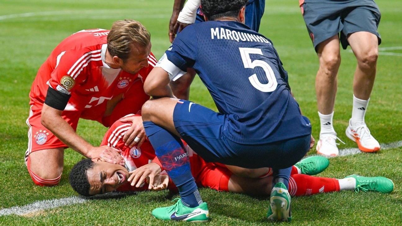 Bayern Munich’s Jamal Musiala Suspected to Have Fractured His Fibula